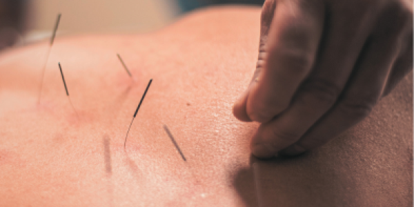 Crowchild-Acupunture.webp